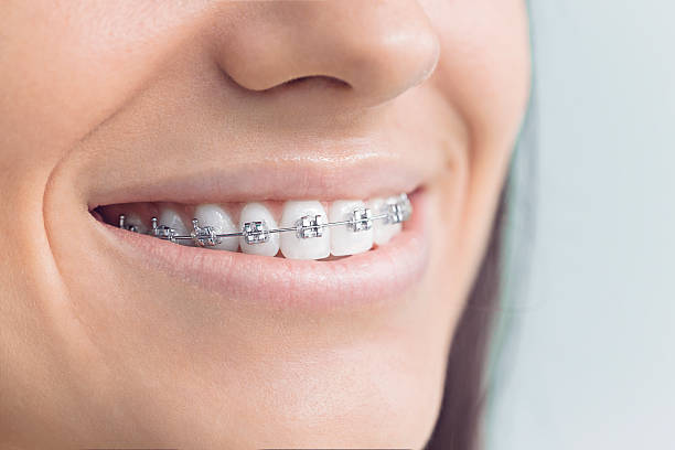 Best Invisalign and Clear Aligners  in Tennille, GA